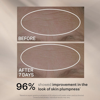 StriVectin Anti-Wrinkle Peptide Plump Line Filling Bounce Serum - 1oz + 0.5oz