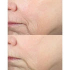 DERMA E Advanced Peptides and Vegan Flora-Collagen Serum – Double Action Collagen Face Cream with Peptide Complex – Intensely Hydrating Serum for Lines, Wrinkles and Redness, 2 oz