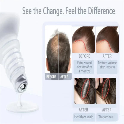 Rosemary & Redensyl Advanced Hair Roll-On for Scalp Care