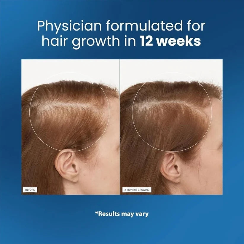 Be Bodywise Hair Roll-On for Scalp Care & Hair Strengthening