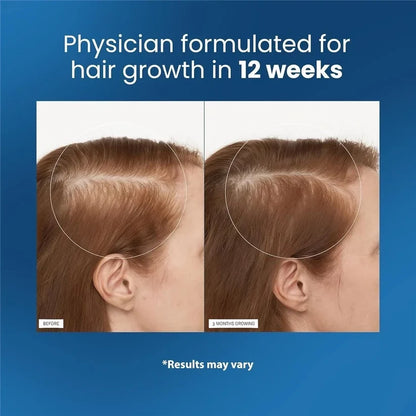 Be Bodywise Hair Roll-On for Scalp Care & Hair Strengthening